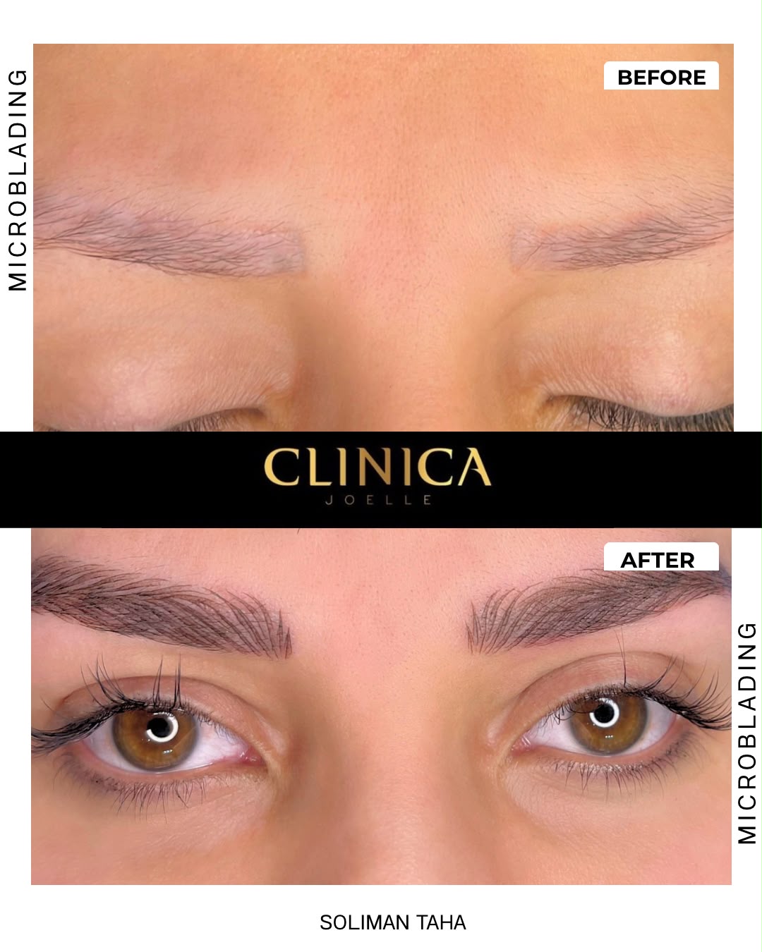 Microblading — before and after