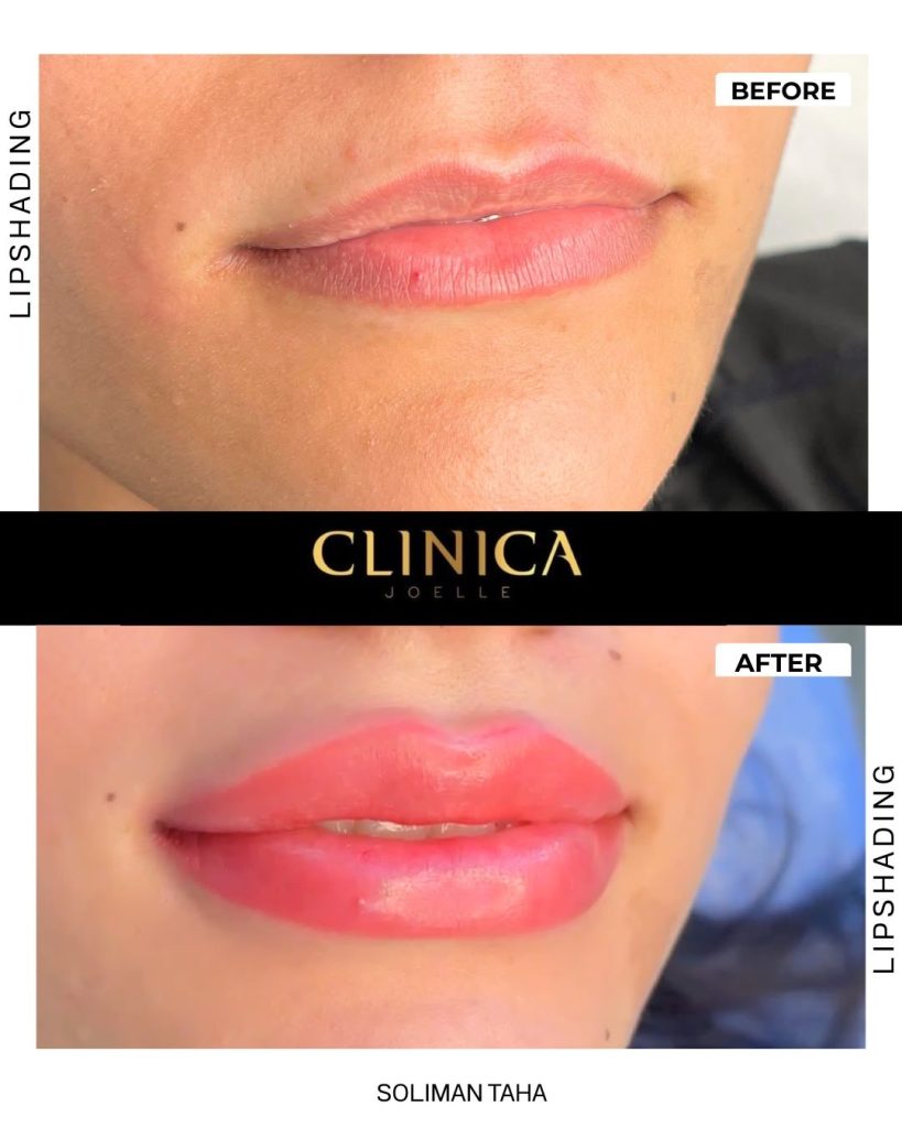 Lip shading – Soliman Taha