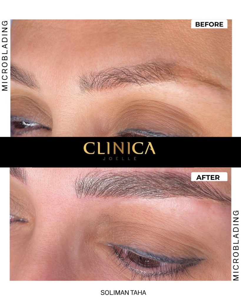 Microblading III – Soliman Taha