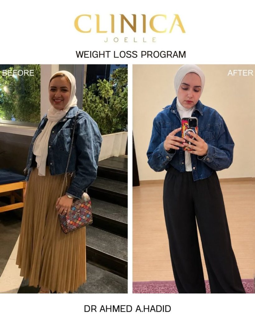 Weight loss program – before and after